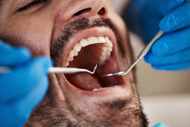 Best Emergency Treatment for Toothache in Oregon, OH